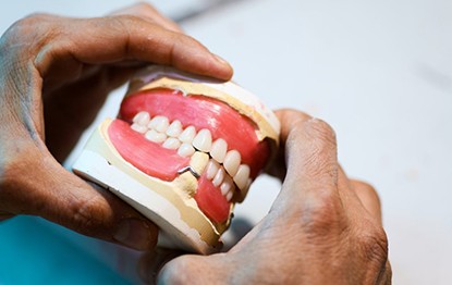 a person holding an incomplete set of dentures